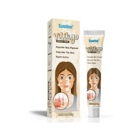 Sumifun Vitiligo Removal Cream
